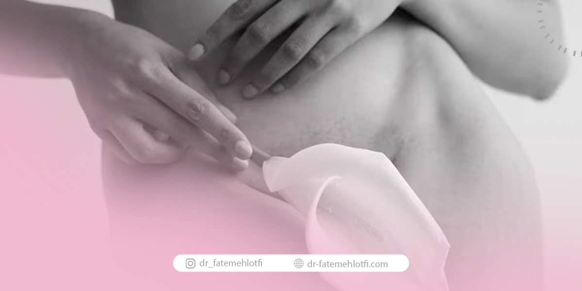 روش های تنگ کردن واژن