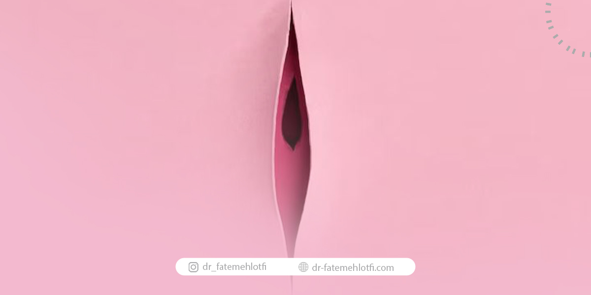 مراقبت های بعد از لابیاپلاستی
